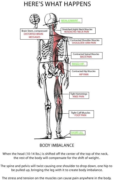 Chiropractic Northbrook IL Nucca Chiropractic Explanation